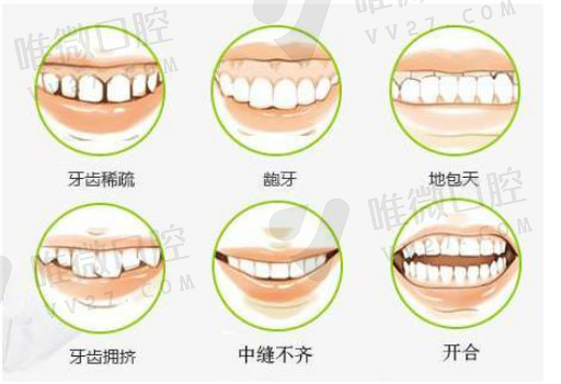 二氧化锆和纤维桩的优缺点（树脂桩和纤维桩的区别）(图1)